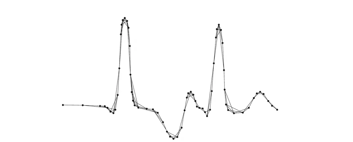 Overfitting vs Underfitting in Machine Learning Algorithms